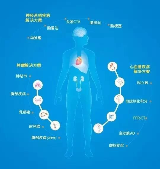 心脑血管疾病被两会重点关注,谈谈AI能帮点儿什么? 心脑血管疾病被两会重点关注,谈谈AI能帮点儿什么?