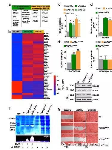 《Nat Commun》：HDAC9-MALAT1-BRG1复合物介导胸主动脉瘤平滑肌功能障碍
