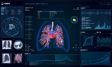 原研创新再获突破!推想医疗获批4项国家自然科学基金项目 原研创新再获突破!推想医疗获批4项国家自然科学基金项目