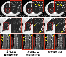 世界第一！推想包揽MICCAI 2022两大国际挑战赛冠军