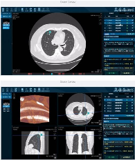 AI芯天下丨趋势丨AI阅片将改变AI落地医疗领域的速度