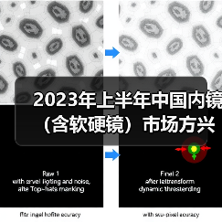 2023年上半年中国内镜(含软硬镜)市场方兴未艾(图2) 2023年上半年中国内镜(含软硬镜)市场方兴未艾(图2)