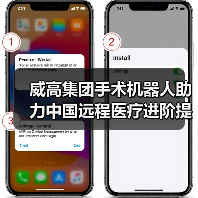 威高集团手术机器人助力中国远程医疗进阶提速(图1) 威高集团手术机器人助力中国远程医疗进阶提速(图1)