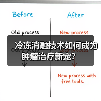 冷冻消融技术如何成为肿瘤治疗新宠?(图2) 冷冻消融技术如何成为肿瘤治疗新宠?(图2)