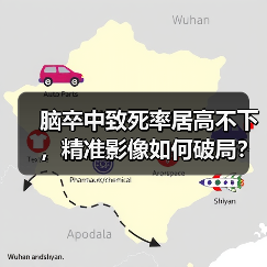 脑卒中致死率居高不下，精准影像如何破局？（图2）