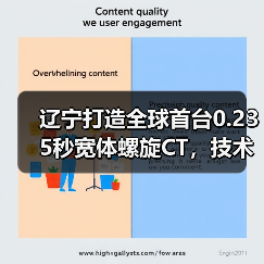 辽宁打造全球首台0.235秒宽体螺旋CT,技术突破如何?(图2) 辽宁打造全球首台0.235秒宽体螺旋CT,技术突破如何?(图2)