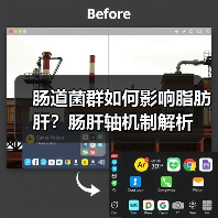 肠道菌群如何影响脂肪肝?肠肝轴机制解析(图4) 肠道菌群如何影响脂肪肝?肠肝轴机制解析(图4)
