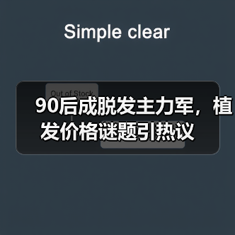 90后成脱发主力军,植发价格谜题引热议(图1) 90后成脱发主力军,植发价格谜题引热议(图1)