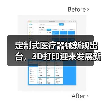 定制式医疗器械新规出台,3D打印迎来发展新机遇?(图4) 定制式医疗器械新规出台,3D打印迎来发展新机遇?(图4)